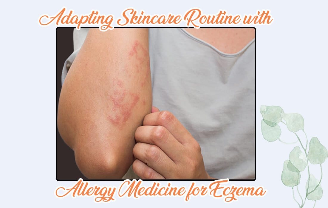 Adapting Skincare Routine with Allergy medicine for Eczema
