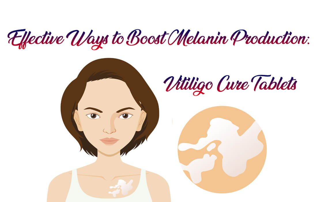 Effective Ways to Boost Melanin Production: Vitiligo Cure Tablets